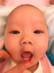 宝宝身体3个部位一定不能碰