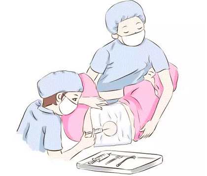 万州月嫂：打无痛分娩针有危害么？